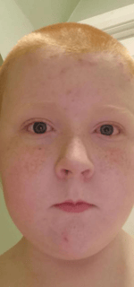 dio s amendment yt 5s