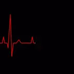 (distant, distorted) heart rate monitor