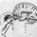 lobotomy sound effect