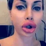 labios