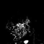 indian scammer microsoftore support 2