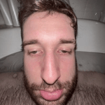 bURP