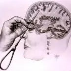 Lobotomy