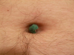 thats a bellybutton