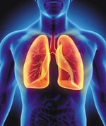 Pneumonoultramicroscopicsilicovolcanoconiosis