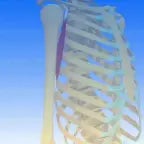 Nyeri otot bersama mamank garox