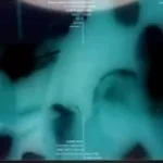 dreamybull as a pilot hurt himself