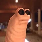 Marcus: There has been numerous Injuries