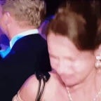 Millions to the face