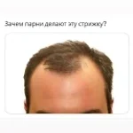 LOOK AT THE TOP OF HIS HEAD