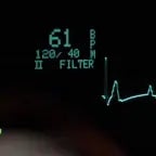 (distant, distorted) heart rate monitor (layer3)