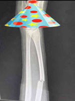 Seether Something In The Way (Nirvana Cover Live Acoustic, 2002