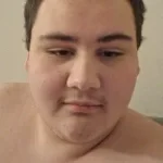 oofhead mass reported