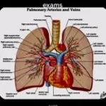 lung cancer