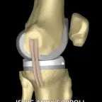 Kochana pokaż mi kolana...