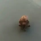 start diggin in your butt