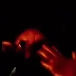 bugs under your skin