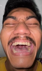 Acumalaka meme acumalaka meme