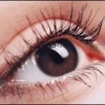 Bugs in my eye bugs in my skin