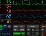 Normal Monitor Sound