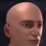 Ultimate brain aneurysm