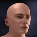 brain-aneurysm (copy) - Sound