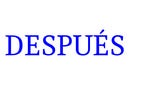 despues
