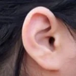Ear Ringing - had6s (copy)