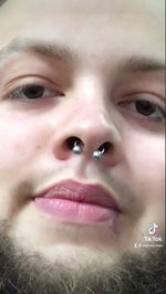 29 years old with dementia