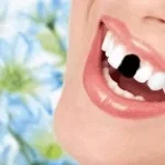 Le è caduto un dente