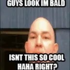 baldy baldy louder