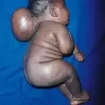 Childishly Fresh Eyes