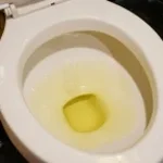 Pee