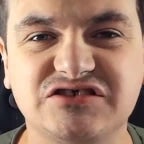 Spørg casper elsker R*VHUL