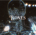 Bones