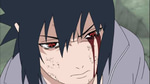 Sasuke- "Im very irritated right now"