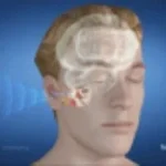 High Pitch Frequency Hurts